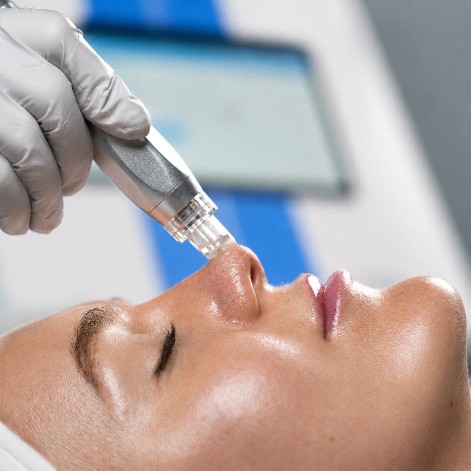 Zemits demonstration of a clear-tipped handpiece on a model’s skin